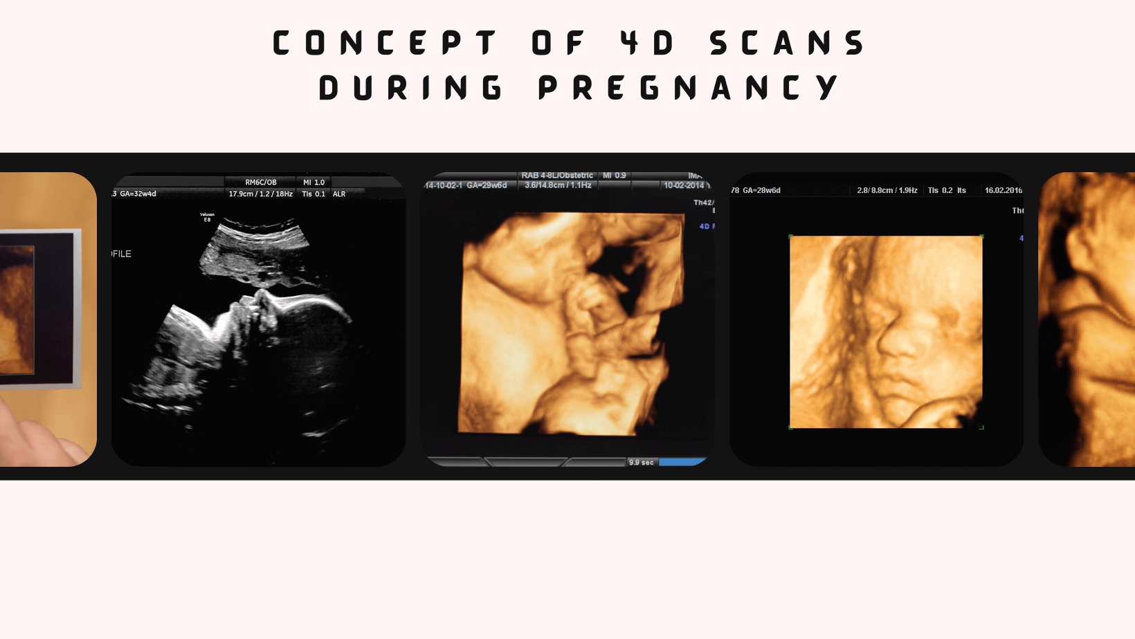 Concept of 4D Scans during Pregnancy