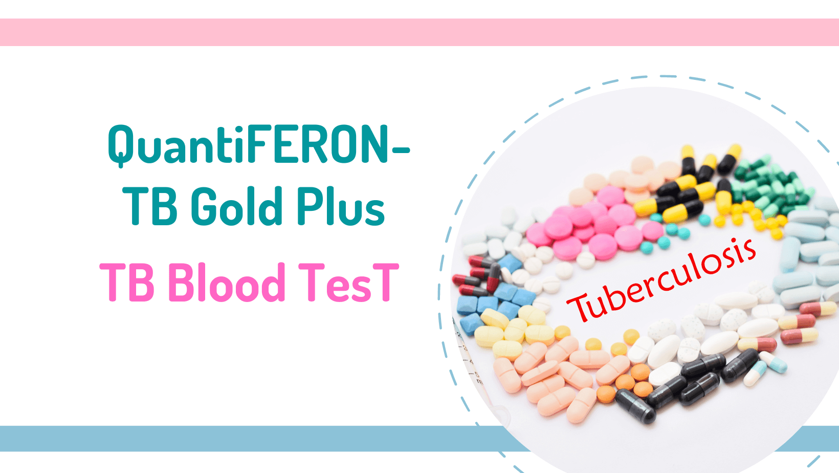 Tuberculosis Blood Test QuantiFERON TB Gold Plus Miracle Inside