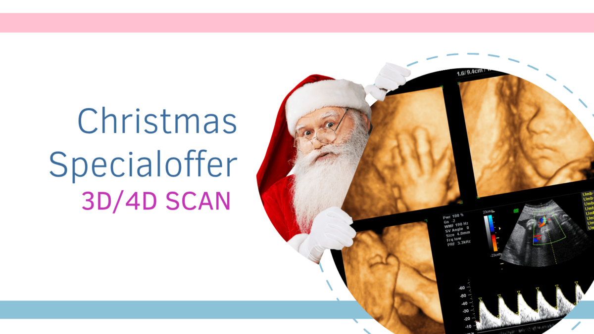 Christmas 3D/4D Scan Offers in Leeds