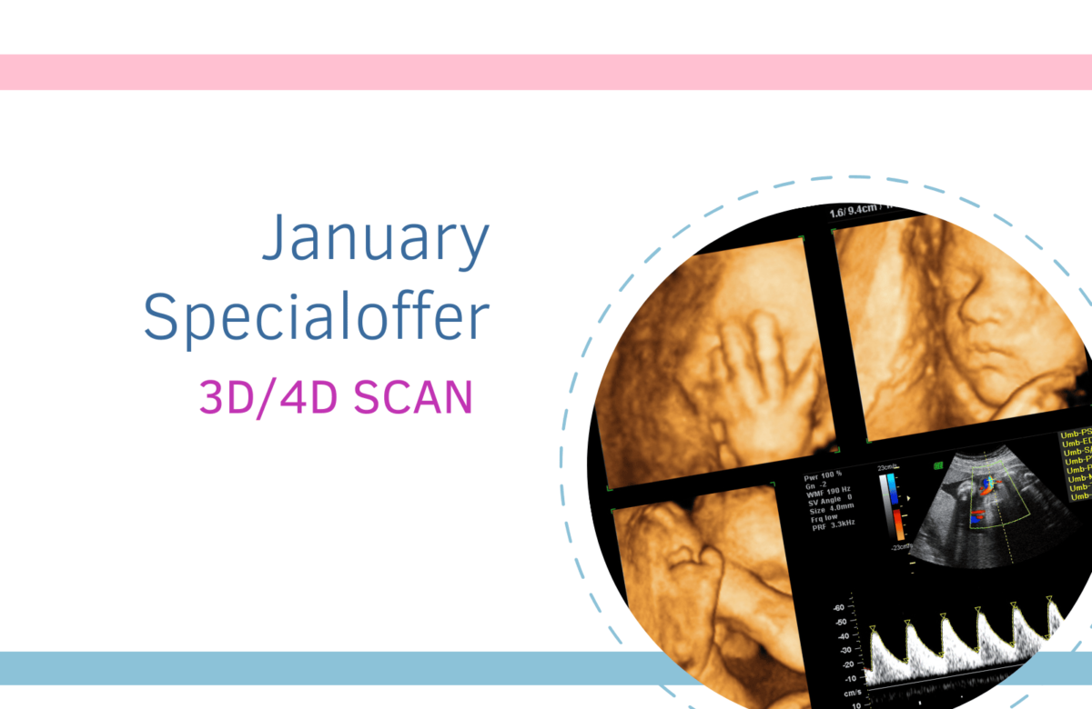 January SPl 3d/4d scan offer