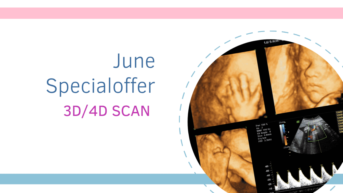 june 3D/4D scan offer