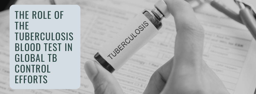 The Role of the Tuberculosis Blood Test in Global TB Control Efforts